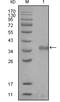 Nuclear receptor corepressor 1 antibody, M01304, Boster Biological Technology, Western Blot image 