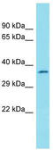 YdjC Chitooligosaccharide Deacetylase Homolog antibody, TA334789, Origene, Western Blot image 