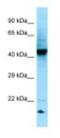 Retrograde Golgi transport protein RGP1 homolog antibody, NBP1-98602, Novus Biologicals, Western Blot image 
