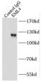 EMAP Like 4 antibody, FNab02758, FineTest, Immunoprecipitation image 