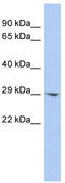 Enoyl-CoA Hydratase Domain Containing 2 antibody, TA346796, Origene, Western Blot image 