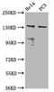Mov10 Like RISC Complex RNA Helicase 1 antibody, LS-C680875, Lifespan Biosciences, Western Blot image 