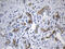 Interleukin 2 antibody, M00387-1, Boster Biological Technology, Immunohistochemistry paraffin image 