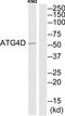 Autophagy Related 4D Cysteine Peptidase antibody, TA315948, Origene, Western Blot image 