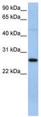 Eukaryotic Translation Initiation Factor 4H antibody, TA343912, Origene, Western Blot image 