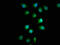 Formin 1 antibody, CSB-PA715012LA01HU, Cusabio, Immunofluorescence image 