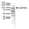 Zinc Finger And BTB Domain Containing 4 antibody, TA347317, Origene, Western Blot image 