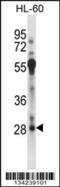 Regulatory Factor X Associated Protein antibody, 57-775, ProSci, Western Blot image 