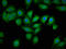 Endothelial Cell Surface Expressed Chemotaxis And Apoptosis Regulator antibody, LS-C674704, Lifespan Biosciences, Immunofluorescence image 