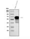 Steroid sulfatase antibody, A01198-2, Boster Biological Technology, Western Blot image 