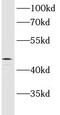 Activating Signal Cointegrator 1 Complex Subunit 1 antibody, FNab00627, FineTest, Western Blot image 