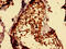 Makorin Ring Finger Protein 2 antibody, CSB-PA872420LA01HU, Cusabio, Immunohistochemistry paraffin image 