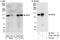 Protein SMG7 antibody, A302-170A, Bethyl Labs, Immunoprecipitation image 