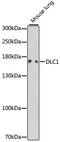 DLC1 Rho GTPase Activating Protein antibody, A1921, ABclonal Technology, Western Blot image 