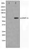 Matrix Metallopeptidase 16 antibody, TA347433, Origene, Western Blot image 