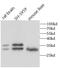2-Aminoethanethiol Dioxygenase antibody, FNab10394, FineTest, Western Blot image 