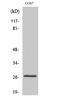 Dual Specificity Phosphatase 19 antibody, STJ92788, St John