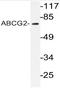 ATP Binding Cassette Subfamily G Member 2 (Junior Blood Group) antibody, AP20605PU-N, Origene, Western Blot image 