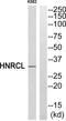 Heterogeneous Nuclear Ribonucleoprotein C Like 1 antibody, PA5-39204, Invitrogen Antibodies, Western Blot image 