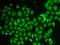 Aldo-Keto Reductase Family 1 Member A1 antibody, LS-C748623, Lifespan Biosciences, Immunofluorescence image 
