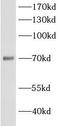 Long-chain-fatty-acid--CoA ligase 5 antibody, FNab00109, FineTest, Western Blot image 
