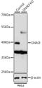 G Protein Subunit Alpha I3 antibody, A03077, Boster Biological Technology, Western Blot image 