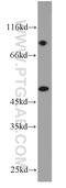 Keratin 18 antibody, 18708-1-AP, Proteintech Group, Western Blot image 