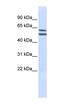 Phosphatidylinositol Glycan Anchor Biosynthesis Class Q antibody, orb325272, Biorbyt, Western Blot image 