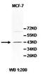 Protein-L-Isoaspartate (D-Aspartate) O-Methyltransferase Domain Containing 1 antibody, orb77894, Biorbyt, Western Blot image 