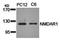 Glutamate Ionotropic Receptor NMDA Type Subunit 1 antibody, orb14538, Biorbyt, Western Blot image 