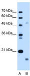 Zinc Metallopeptidase STE24 antibody, TA339028, Origene, Western Blot image 