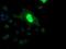 ETS Proto-Oncogene 2, Transcription Factor antibody, NBP2-45543, Novus Biologicals, Immunofluorescence image 