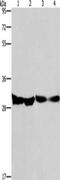 2,4-Dienoyl-CoA Reductase 1 antibody, CSB-PA040684, Cusabio, Western Blot image 