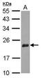 Nudix Hydrolase 3 antibody, PA5-30435, Invitrogen Antibodies, Western Blot image 