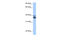 MyoD Family Inhibitor Domain Containing antibody, 30-672, ProSci, Western Blot image 