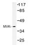 Mevalonate Kinase antibody, AP20432PU-N, Origene, Western Blot image 