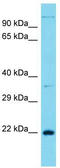 Cancer/Testis Antigen Family 45 Member A1 antibody, TA332257, Origene, Western Blot image 