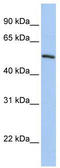 Kruppel Like Factor 11 antibody, TA343415, Origene, Western Blot image 