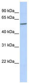 Sperm-associated antigen 8 antibody, TA330951, Origene, Western Blot image 