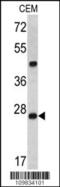 Dicer 1, Ribonuclease III antibody, MBS9202372, MyBioSource, Western Blot image 