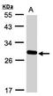 Yip1 Domain Family Member 4 antibody, LS-C185828, Lifespan Biosciences, Western Blot image 