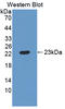CKLF Like MARVEL Transmembrane Domain Containing 8 antibody, LS-C375008, Lifespan Biosciences, Western Blot image 