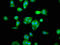 RNA Binding Motif Protein 45 antibody, LS-C672380, Lifespan Biosciences, Immunofluorescence image 