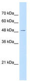 Wnt Ligand Secretion Mediator antibody, TA335292, Origene, Western Blot image 