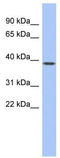Homeobox protein engrailed-1 antibody, TA335190, Origene, Western Blot image 