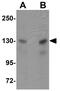 Microtubule Associated Scaffold Protein 2 antibody, GTX85202, GeneTex, Western Blot image 