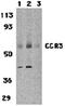 C-C Motif Chemokine Receptor 3 antibody, orb74313, Biorbyt, Western Blot image 