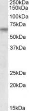 Tetratricopeptide Repeat Domain 8 antibody, TA311574, Origene, Western Blot image 