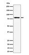 Leukocyte Receptor Tyrosine Kinase antibody, M04217, Boster Biological Technology, Western Blot image 
