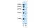 Solute Carrier Family 25 Member 39 antibody, GTX46814, GeneTex, Western Blot image 